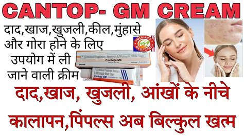 Cantop GM Cream Best Skin Glow Cream Kil Muhase Pimples Skin Daad