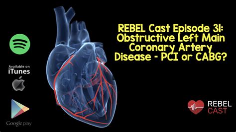 Left Main Coronary Artery Occlusion Archives - REBEL EM - Emergency ...