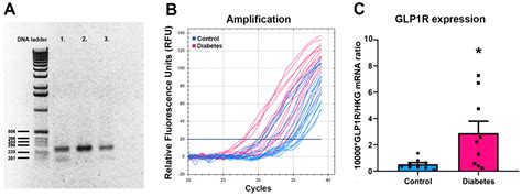 Ijms Free Full Text Elevated Glucagon Like Peptide 1 Receptor Level