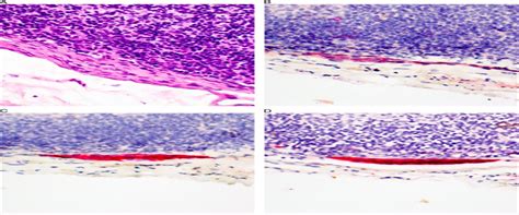 Comprehensive Clinical Histopathologic And Molecular Analy The