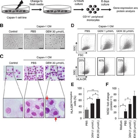 Supernatants Of Human PDAC Cell Culture Induce The Differentiation Of