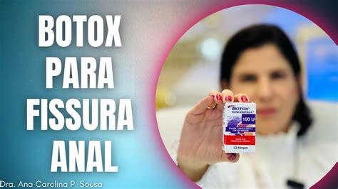 Botox Para Fissura Anal Melhor Tratamento Para Fissuras Youtube