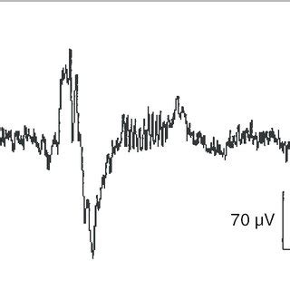 Typical K-complex with subsequent sleep spindle. | Download Scientific Diagram