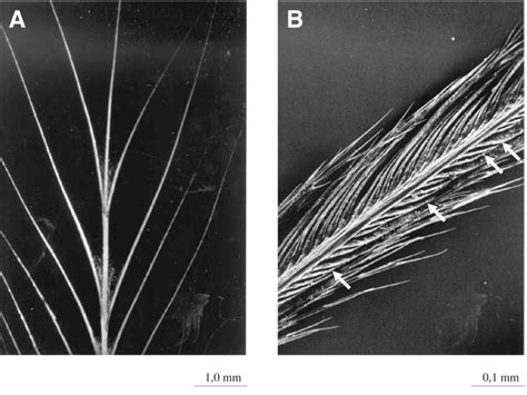 Details In Development Of Barbs Of Auricular Feathers A Barbules Are