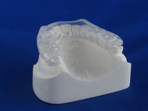 Biteguard Or Occlusal Splint