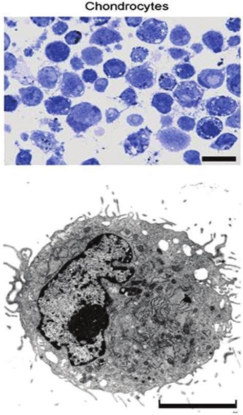 Optical Micrograph Of Chondrocytes In Culture Stained With Toluidine