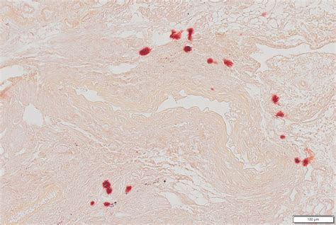 Vitroview Alizarin Red Stain Kit Tissue Calcium Staining