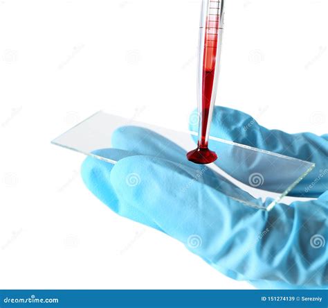 Doctor Dripping Blood Sample From Dropper Onto Glass On White