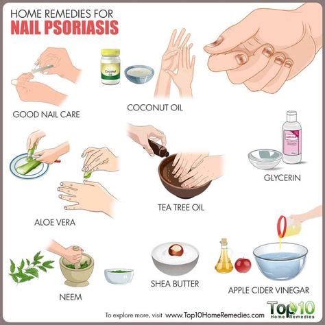 12 Best Nail Psoriasis ideas | nail psoriasis, psoriasis, nail problems