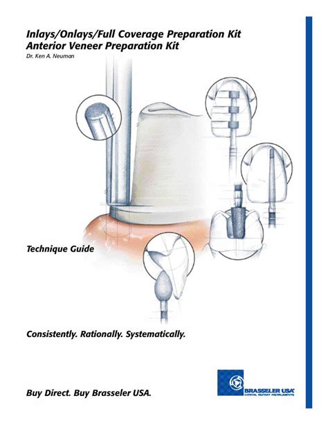 PDF Inlays Onlays Full Coverage Preparation Kit Anterior