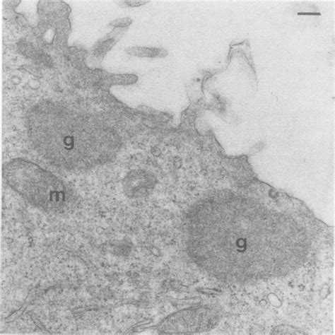 Detail from periphery of L132 cell at metaphase; the keratin 'speckles ...