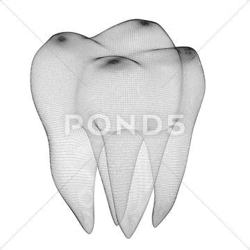 Human Tooth Wire Frame On The Background Royalty Free