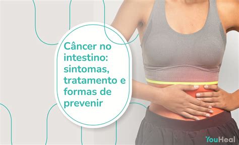 Câncer no intestino sintomas tratamento e formas de prevenir