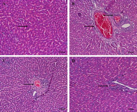 Effect Of Europinidin Against Alcohol Induced Liver Damage In Rats By