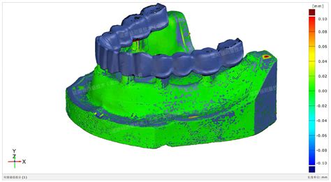 三维扫描技术助力数字化口腔修复精准“种植”诺斯顿 专业三维测量解决方案提供商 三维扫描仪 无人机倾斜摄影系统 三维扫描服务