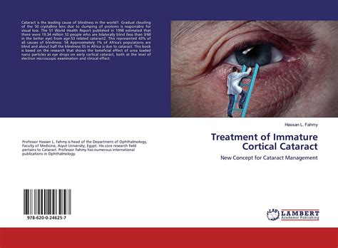 Cortical Cataract The Different Types Of Cataracts And Their Impact On