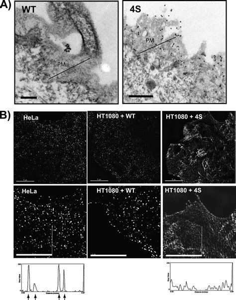 Immunoelectron And Super Resolution Microscopic Analysis Of Plasma