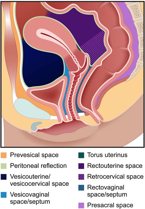 Pelvic Organs Female Diagram Representative Image Of The Pelvic Floor Ligaments And