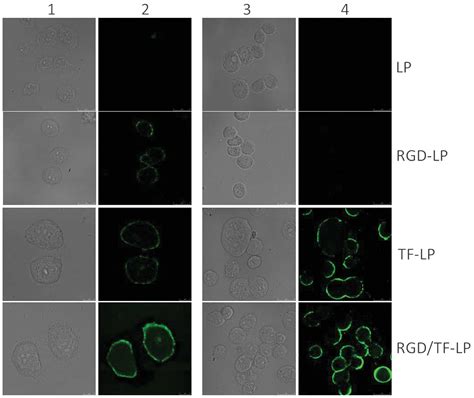 A Dualtargeting Liposome Conjugated With Transferrin And Arginine