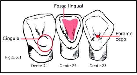 Aula De Anatomia Dental Incisivo Lateral Superior Dente E