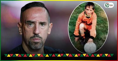 L Histoire Déchirante Des Cicatrices Faciales De Franck Ribéry