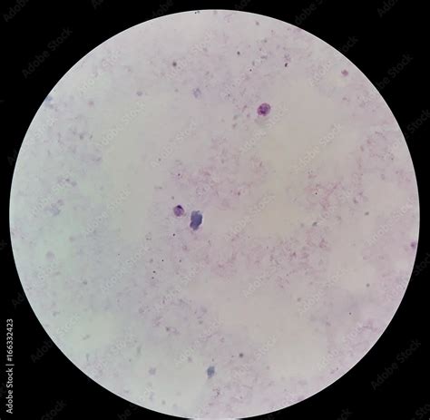 Fotografia Do Stock Under X Light Microscope Human Parasite On