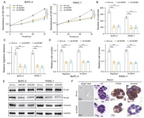 科研思路丨j Hematol Oncol（if23）丨外泌体lncrna测序助力发现linc00623促进胰腺癌进展的分子机制 知乎