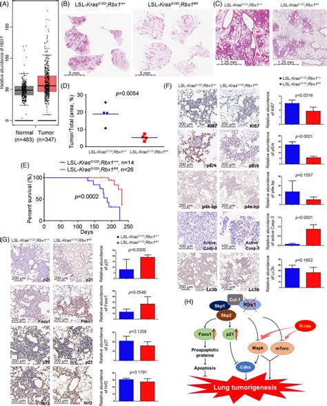 Rbx1 Inactivation Suppressed Lung Tumorigenesis Driven By Krasg12d A