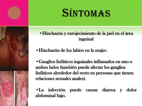 Linfogranuloma Venereo Ppt