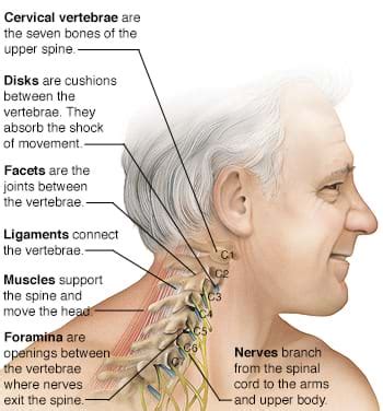 chiropractic solutionschiropractor norwoodneck pain relief
