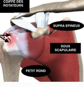 La Coiffe Des Rotateurs Clinique De L Arthrose