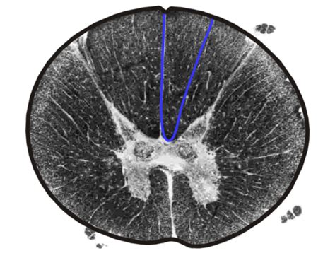 Thoracic Spinal Cord Cross Sections Flashcards Quizlet