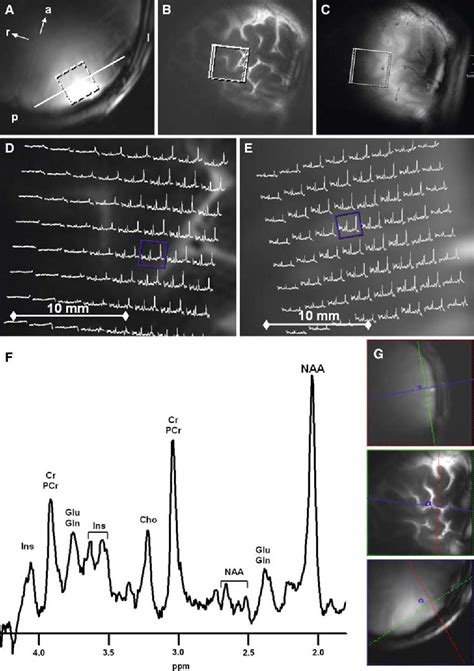 Towards 1H MRSI Of The Human Brain At 7T With Slice Selective Adiabatic