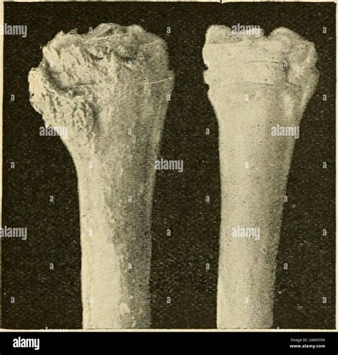 Bone spavin hi-res stock photography and images - Alamy