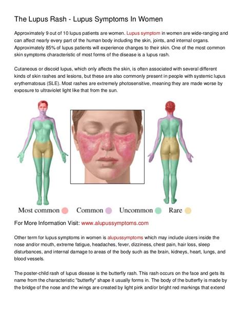 The lupus rash lupus symptoms in women