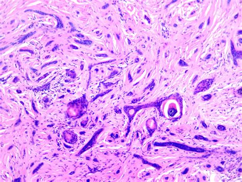 Pathology Outlines WHO Classification