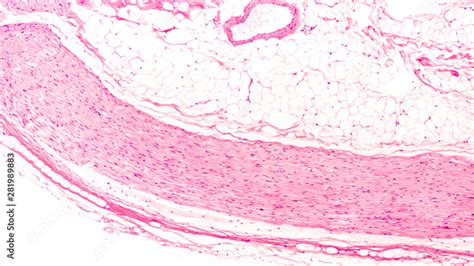 Histology of a peripheral nerve in longitudinal section, composed of ...