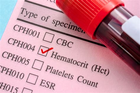 Hematocrito Baixo O Que É - Hematócrito (Hct): o que é e porque está alto ou baixo