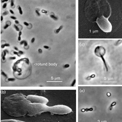 Morphology Of Strain Fc2004 T A Phase Contrast Micrograph Revealing Download Scientific