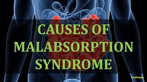 CAUSES OF MALABSORPTION SYNDROME - YouTube