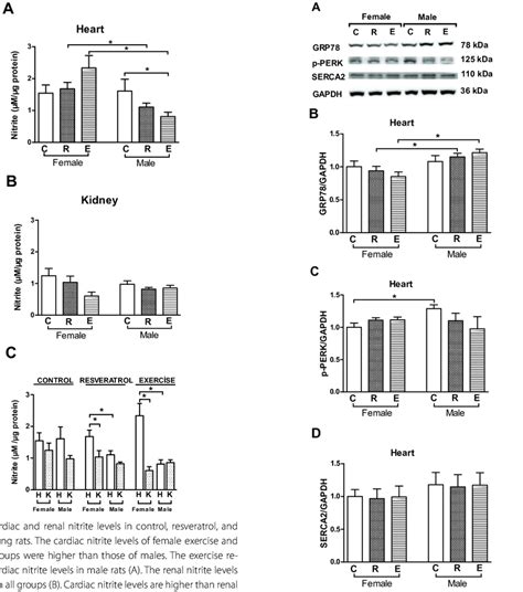 Sex Dependent Effects Of Resveratrol Treatment And Exercise Training On