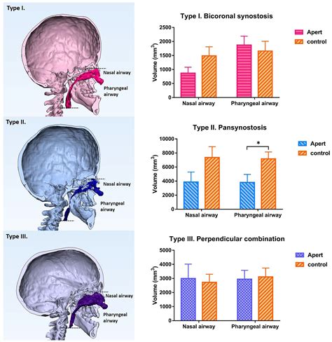 Nasopharyngeal Airway In Brain