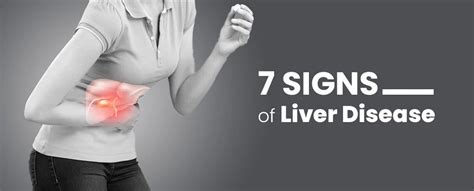 Signs And Symptoms Of Liver Disease