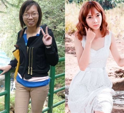 Bị chê giống đàn ông hot girl trà đá chi tiền khủng nâng ngực