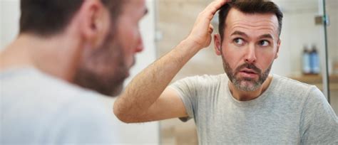 5 Common Causes Of Hair Loss In Men