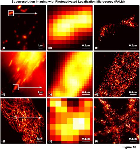 ZEISS Microscopy Online Campus Introduction To Superresolution Microscopy