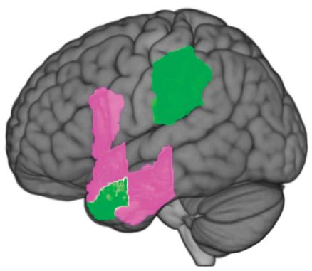 Neurology Medsci Cn