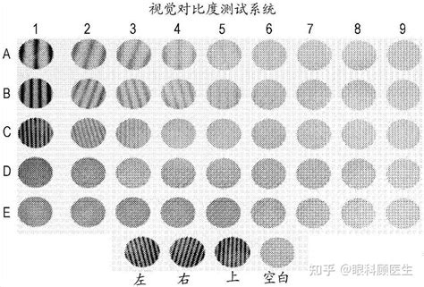 弱视有哪些危害及症状？ 知乎