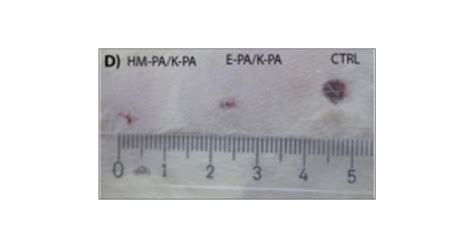 Angiogenic Heparin-Mimetic Peptide Nanofiber Gel Improves Regenerative ... 