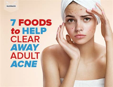 7 Foods To Help Clear Away Adult Acne Clear Skin Diet Acne Skin